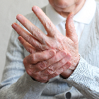 Elderly-man-with-arthritis